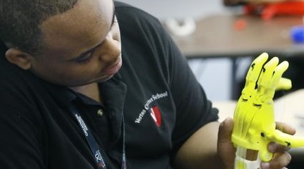 7-year-old receives prosthetic hand